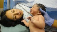 Borzasztó: Császármetszés közben az orvos megvágta a baba arcát is