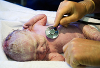 Az ügyeletben születő babák esélyei rosszabbak