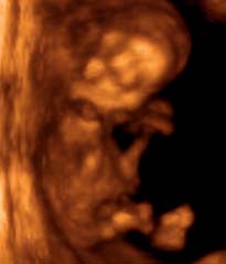 baba a várandósság 11 időszakában