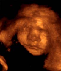 baba a várandósság 29 időszakában
