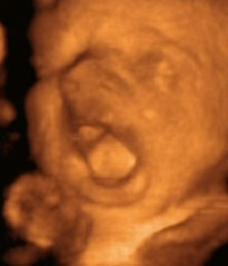 baba a várandósság 35 időszakában