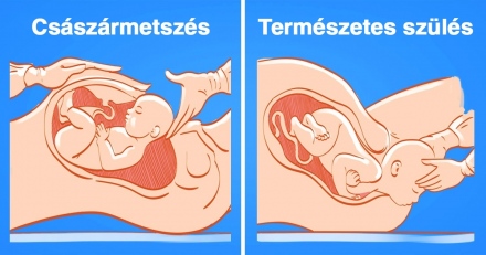 13 terhességi mítosz, amiről a nők többsége rosszul tud és ami sok mindent megváltoztat!