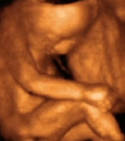 Ultrahang hétről-hétre (hogyan fejlődik a baba)